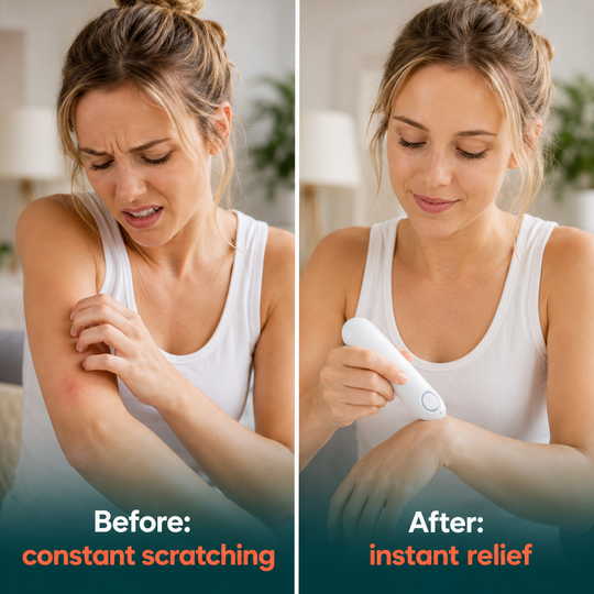 BeetCalm Pen - Finally relief from every mosquito bite
